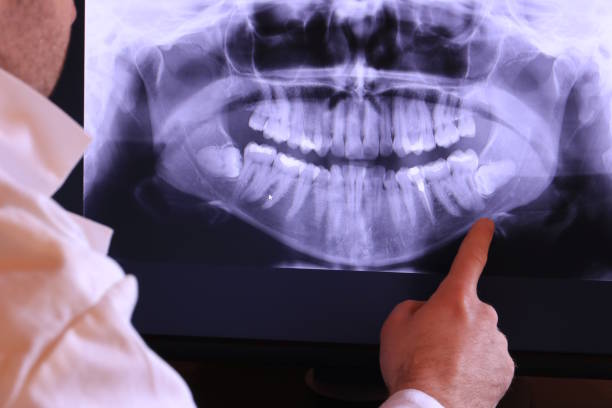 Best Emergency Tooth Extraction in Mountain City, TN